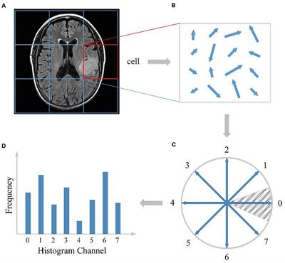 Detection and Grading of Gliomas Using a Novel Two-Phase Machine Learning Method Based on MRI Images